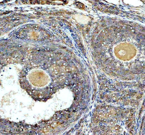 a11205 1 lgtn primary antibodies ihc testing 3