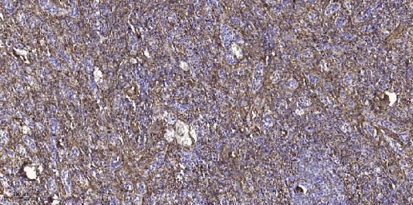 Immunohistochemical analysis of paraffin-embedded human spleen tissue