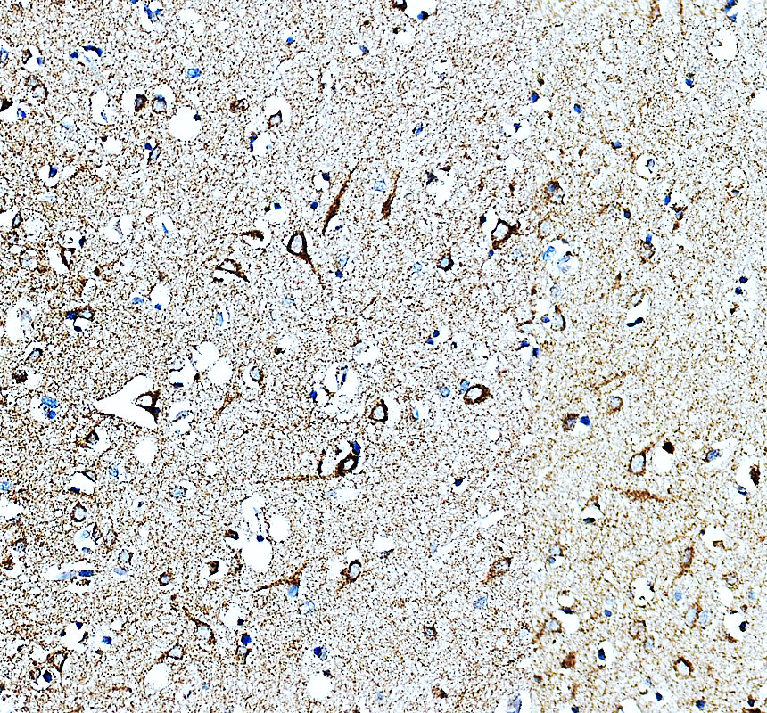a11224 1 ndnf primary antibodies ihc testing 2