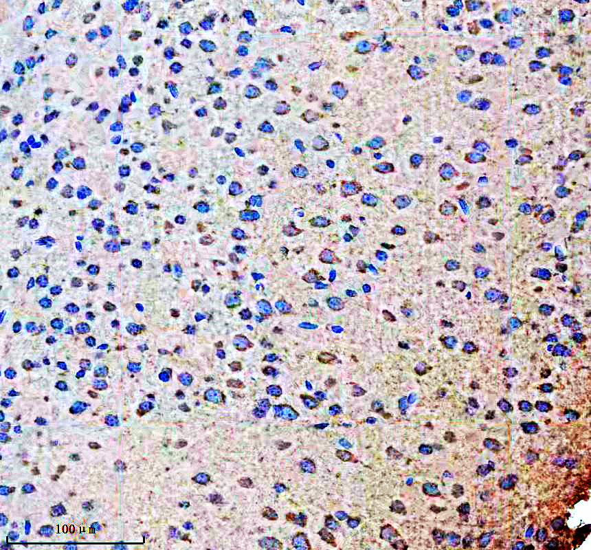 a11224 1 ndnf primary antibodies ihc testing 3