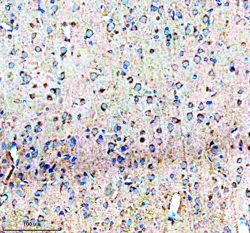 a11224 1 ndnf primary antibodies ihc testing 4