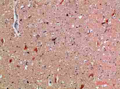 a11226 cd300e primary antibodyes ihc testing 1