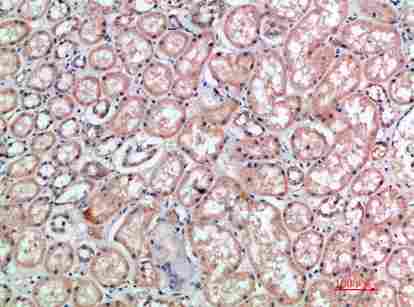 a11226 cd300e primary antibodyes ihc testing 2