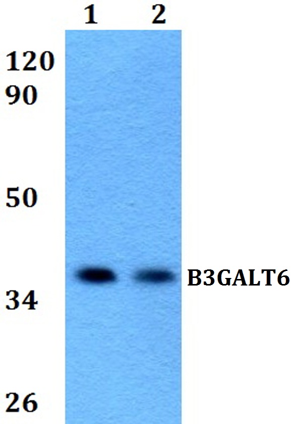 Western blot (WB) analysis of B3GALT6 polyclonal antibody at 1:500 dilution
Lane1:Hela whole cell lysate
Lane2:PC12 whole cell lysate 