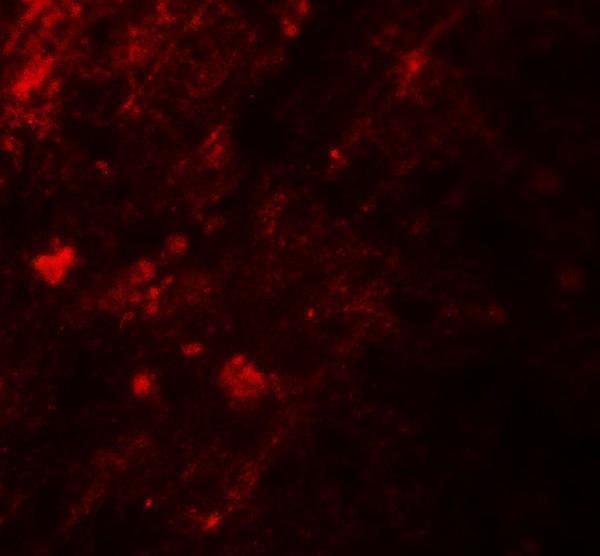 Immunofluorescence of AIG1 in human brain tissue with AIG1 antibody at 20 μg/mL