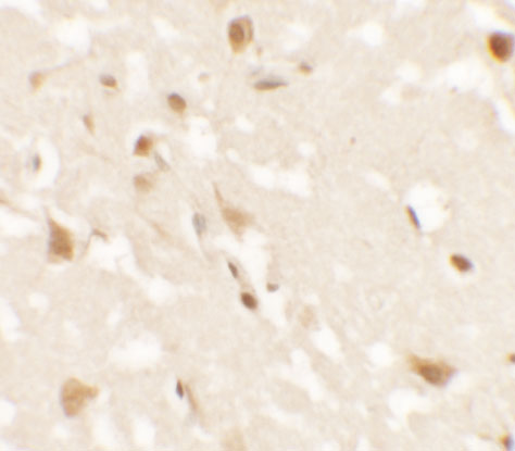 Immunohistochemistry of AIG1 in human brain tissue with AIG1 antibody at 2