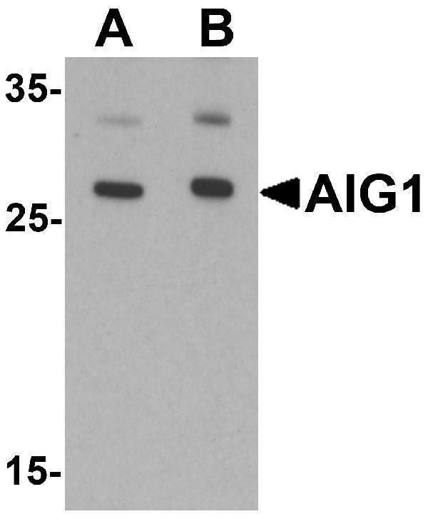 Western blot analysis of AIG1 in human brain tissue lysate with AIG1 antibody at (A) 1 and (B) 2 μg/mL