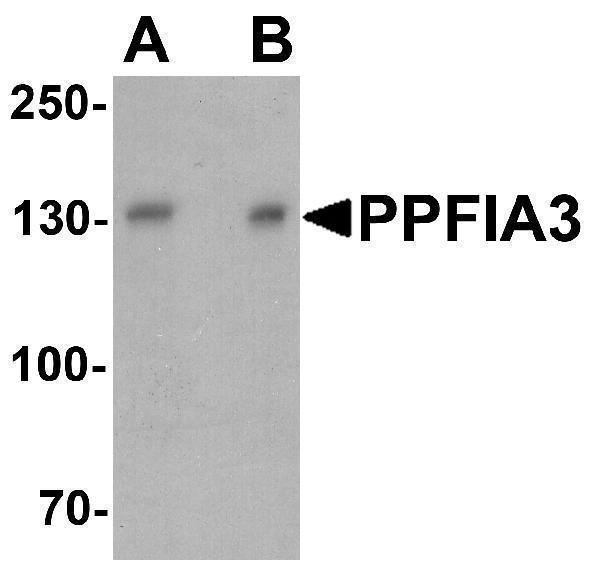 Western blot analysis of PPFIA3 in 293 cell lysate with PPFIA3 antibody at (A) 1 and (B) 2 μg/ml