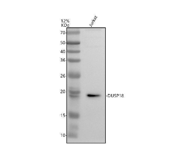 Western blot analysis of DUSP18 using anti-DUSP18 antibody (A11243)
