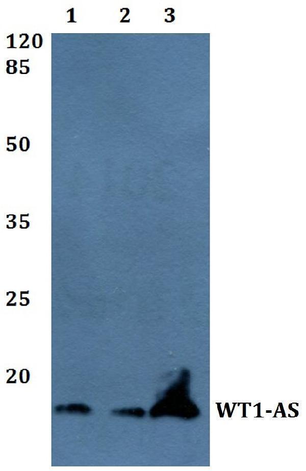 Western blot (WB) analysis of WT1-AS polyclonal antibody at 1:500 dilution
Lane1:A549 whole cell lysate
Lane2:Raw264
