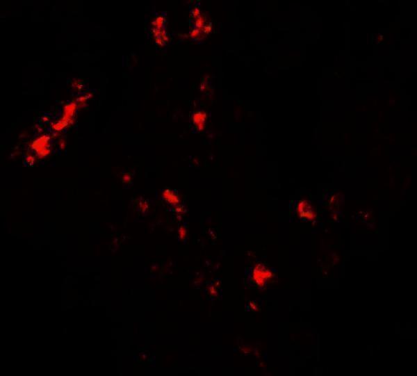 a11251 cmpk2 primary antibodies if testing 2