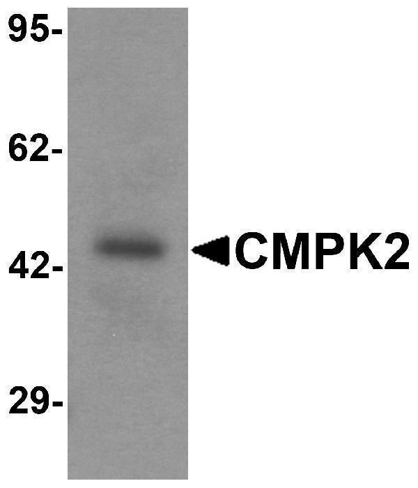 a11251 cmpk2 primary antibodies wb testing 1