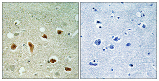 Immunohistochemistry validation of CDKL1 using Anti-KKIALRE CDKL1 Antibody (A11252-1)