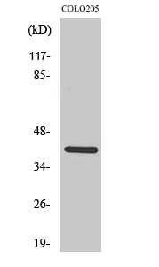 Western blotting validation for Anti-KKIALRE CDKL1 Antibody A11252-1
Western Blot (WB) analysis of specific cells using KKIALRE polyclonal antibody