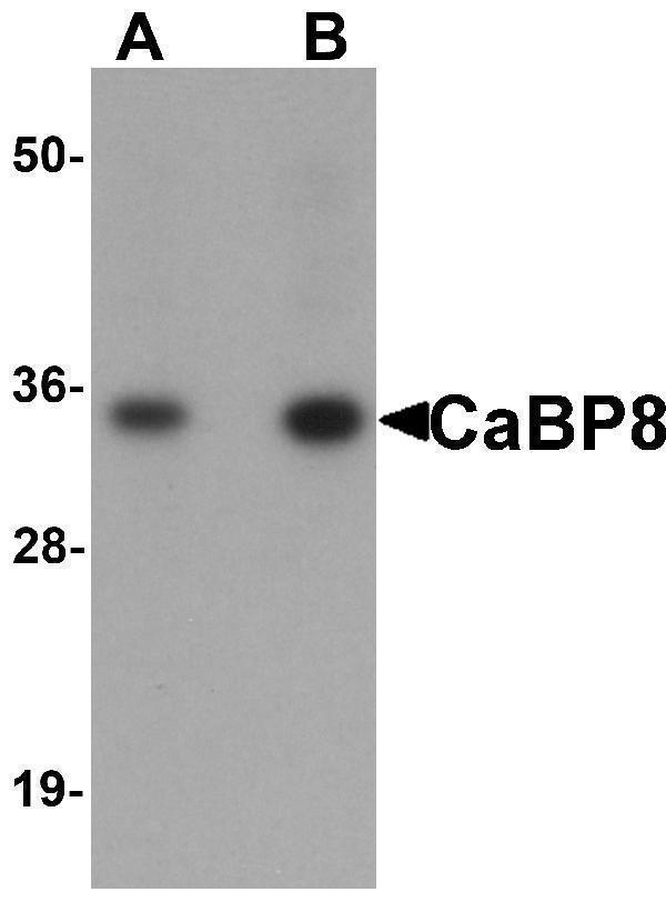 a11254 caln1 primary antibodies wb testing 1