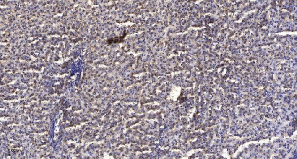 a11256 ghitm primary antibodies ihc testing 1