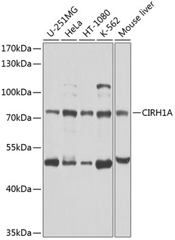 a11262 utp4 primary antiboties wb testing 1