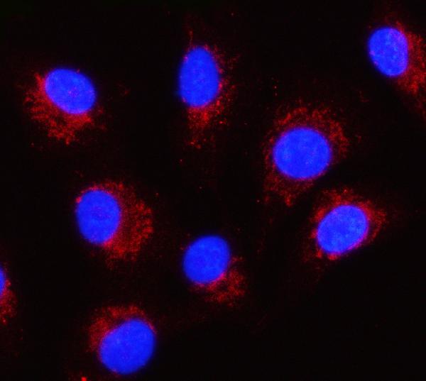 Figure 2. IF analysis of SERPINB8 using anti-SERPINB8 antibody (A11265-1). SERPINB8 was detected in an immunocytochemical section of A549 cells. Enzyme antigen retrieval was performed using IHC enzyme antigen retrieval reagent (AR0022) for 15 mins. The cells were blocked with 10% goat serum. And then incubated with 5 microg/mL rabbit anti-SERPINB8 Antibody (A11265-1) overnight at 4°C. Cy3 Conjugated Goat Anti-Rabbit IgG (BA1032) was used as secondary antibody at 1:500 dilution and incubated for 30 minutes at 37°C. The section was counterstained with DAPI. Visualize using a fluorescence microscope and filter sets appropriate for the label used.