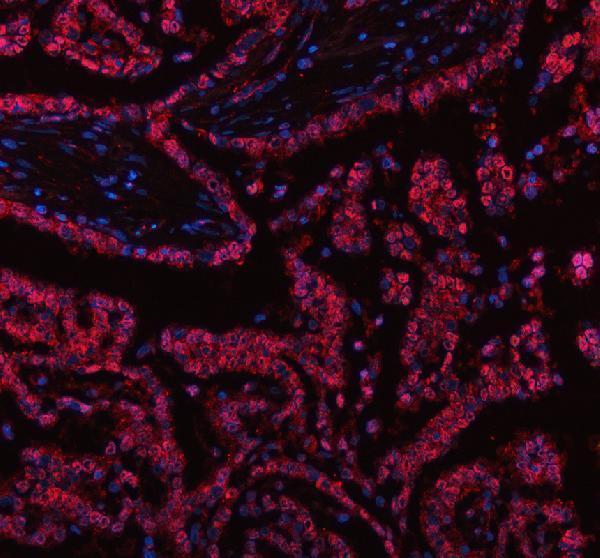 a11270 1 polr2h primary antibodies if testing 2_1
