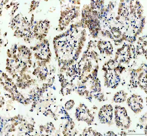 IHC analysis of POLR2H using anti-POLR2H antibody (A11270-1)
