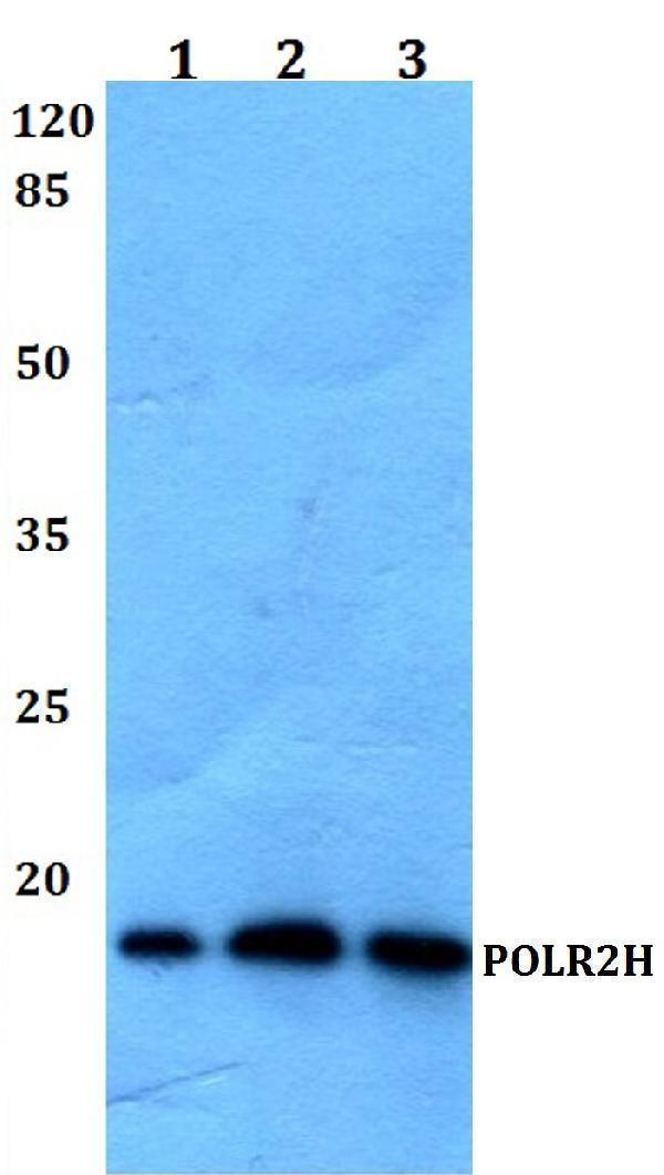 Western blot (WB) analysis of POLR2H polyclonal antibody at 1:500 dilution
Lane1:Hela whole cell lysate
Lane2:Mouse liver tissue lysate
Lane3:Rat iver tissue lysate