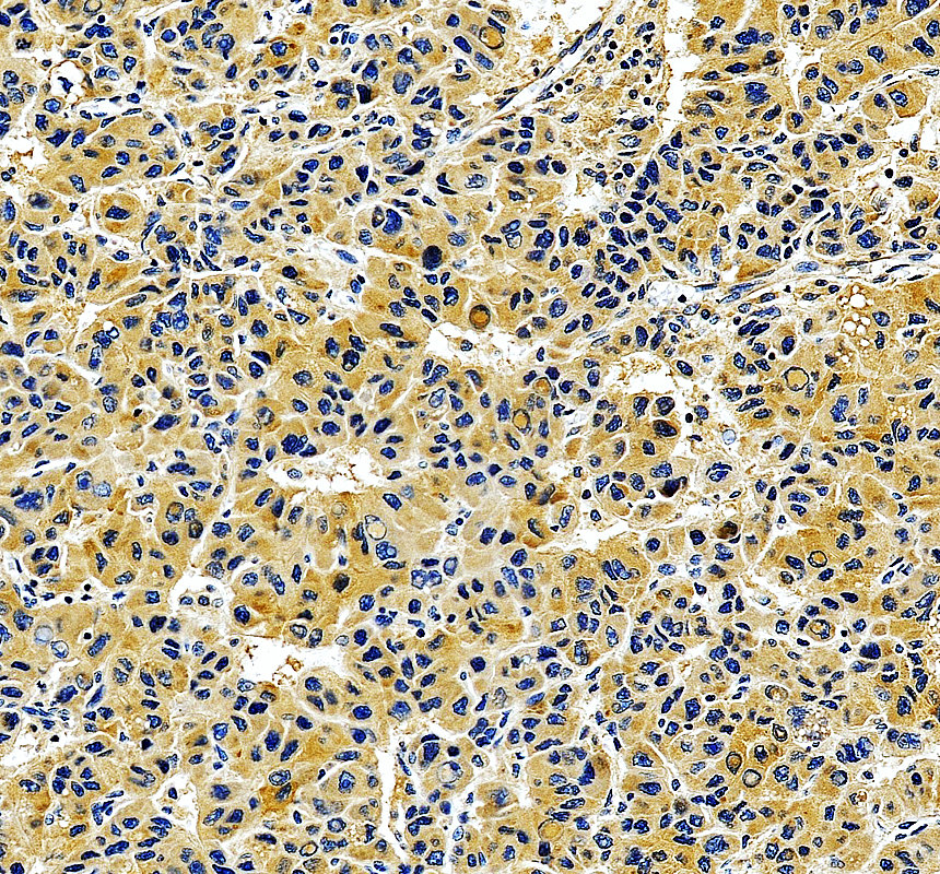 a11274 1 lipt1 primary antibodies ihc testing 1