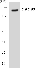 Western blot analysis of the lysates from Jurkat cells using CBCP2 antibody