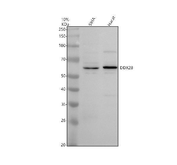 Western blot analysis of DDX28 using anti-DDX28 antibody (A11278)