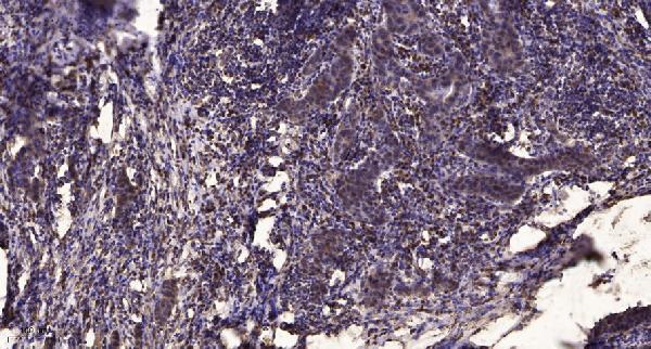 Immunohistochemical analysis of paraffin-embedded human Breast cancer