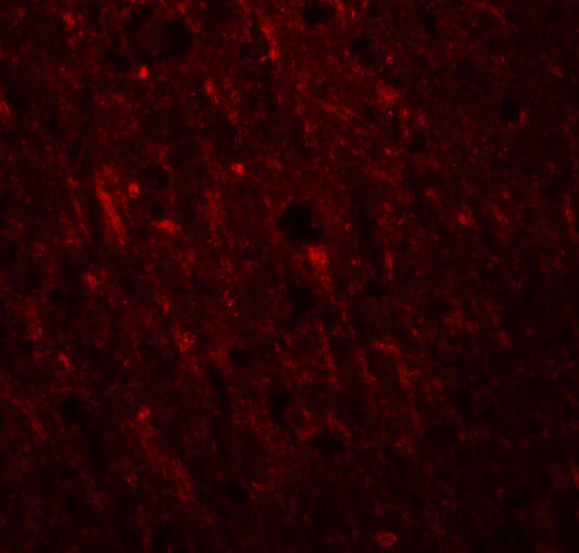 Immunofluorescence of PLEKHM2 in Human Brain cells with PLEKHM2 antibody at 20 μg/mL