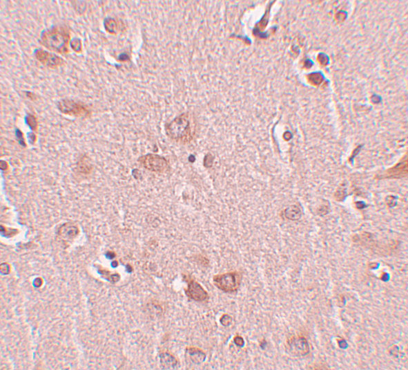 Immunohistochemistry of PLEKHM2 in human liver tissue with FAM59A antibody at 5 μg/mL