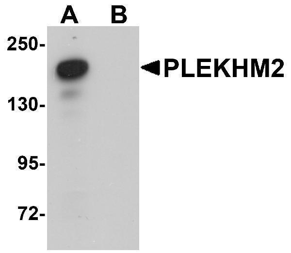 Western blot analysis of PLEKHM2 in rat brain tissue lysate with PLEKHM2 antibody at 0