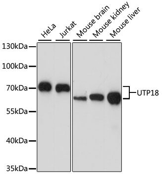 Western blot analysis of extracts of various cell lines, using UTP18 antibody  at 1:1000 dilution