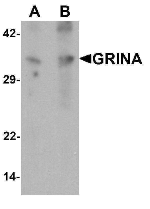 Western blot analysis of GRINA in human testis tissue lysate with GRINA antibody at (A) 1 and (B) 2 μg/mL