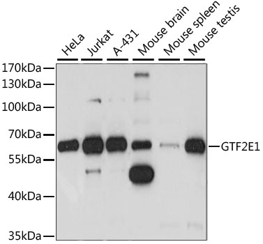 a11288 gtf2e1 primary antiboties wb testing 1