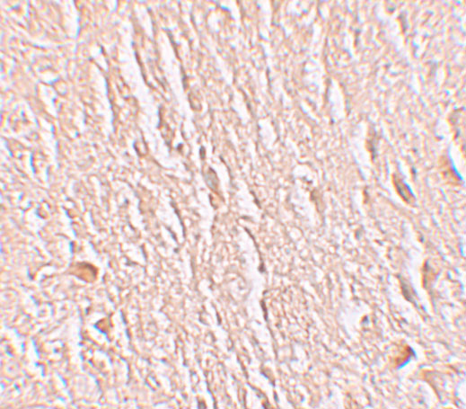 a11290 lrrtm3 primary antibodies ihc testing 2