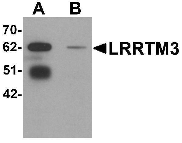 a11290 lrrtm3 primary antibodies wb testing 1