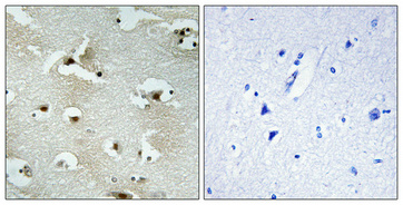 a11298 1 utp14a primary antibodies ihc testing 1