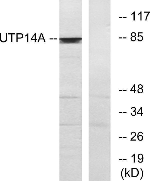 Western blot analysis of lysates from HeLa cells, using UTP14A Antibody