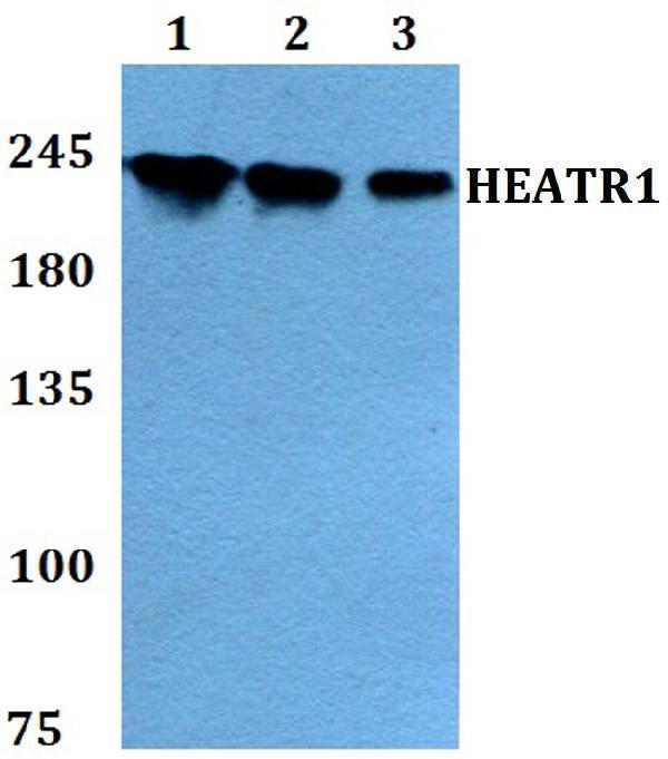 a11299 heatr1 primary antiboties wb testing 1