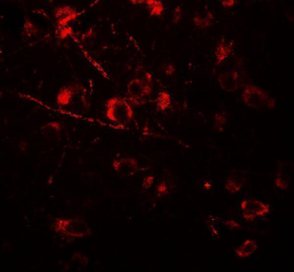Immunofluorescence of AMIGO1 in human brain tissue with AMIGO1 antibody at 20 μg/mL