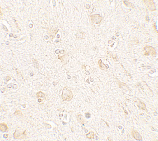 Immunohistochemistry of AMIGO1 in human brain tissue with AMIGO1 antibody at 5 μg/mL