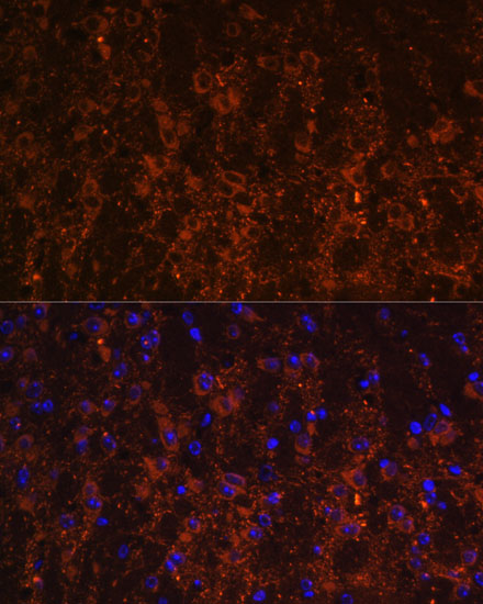 Immunofluorescence analysis of mouse brain using SNX13 antibody  at dilution of 1:100