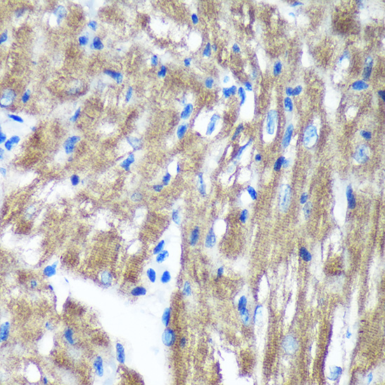 Immunohistochemistry of paraffin-embedded Mouse heart using TIMMDC1 Rabbit pAb  at dilution of 1:100 