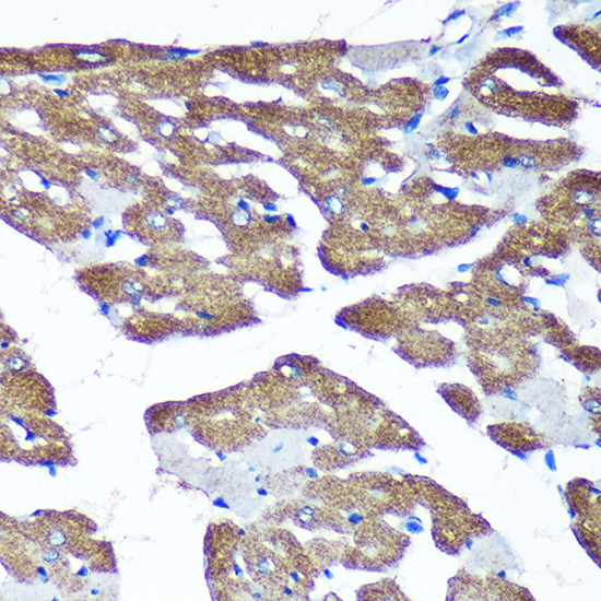 Immunohistochemistry of paraffin-embedded Rat heart using TIMMDC1 Rabbit pAb  at dilution of 1:100 