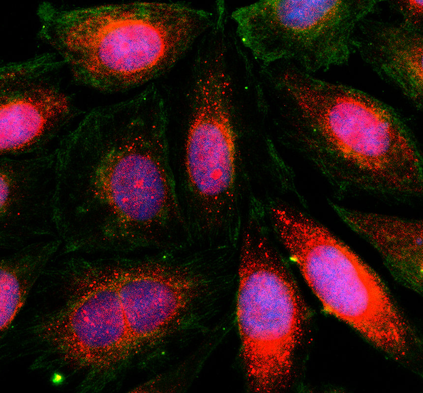 IF analysis of MAST3 using anti-MAST3 antibody (A11312-1) and anti-Alpha Tubulin antibody (M03989-3)