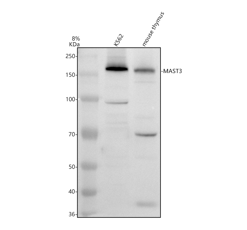 Western blot analysis of MAST3 using anti-MAST3 antibody (A11312-1)