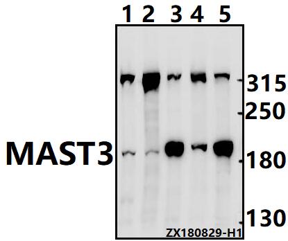 a11312 mast3 primary antiboties wb testing 1