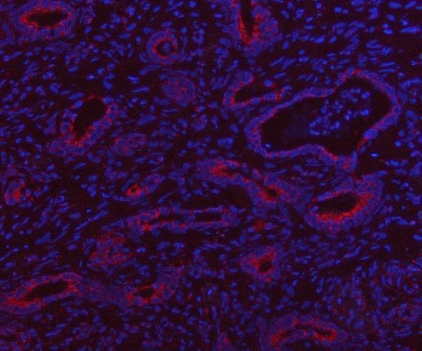 a11317 1 hsdl2 primary antibodies if testing 11