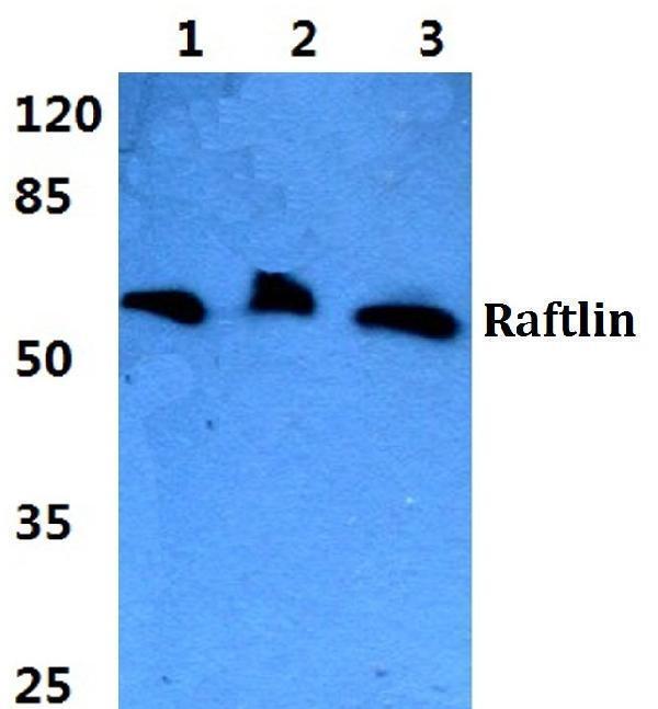 a11324 1 rftn1 primary antiboties wb testing 1